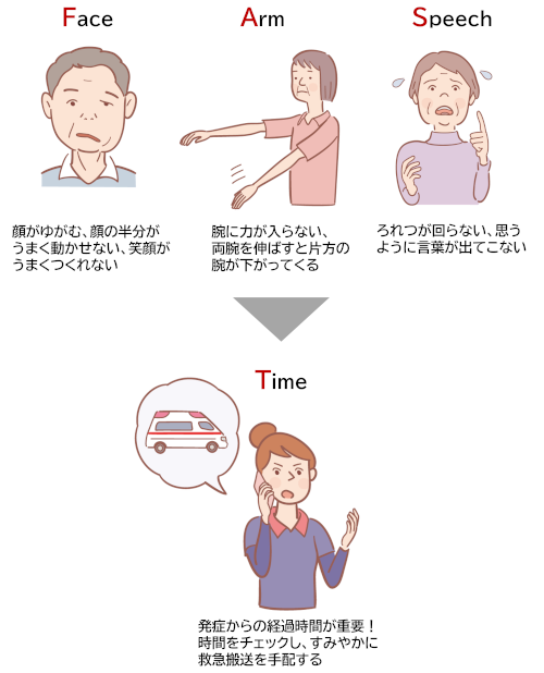 ACT-FAST