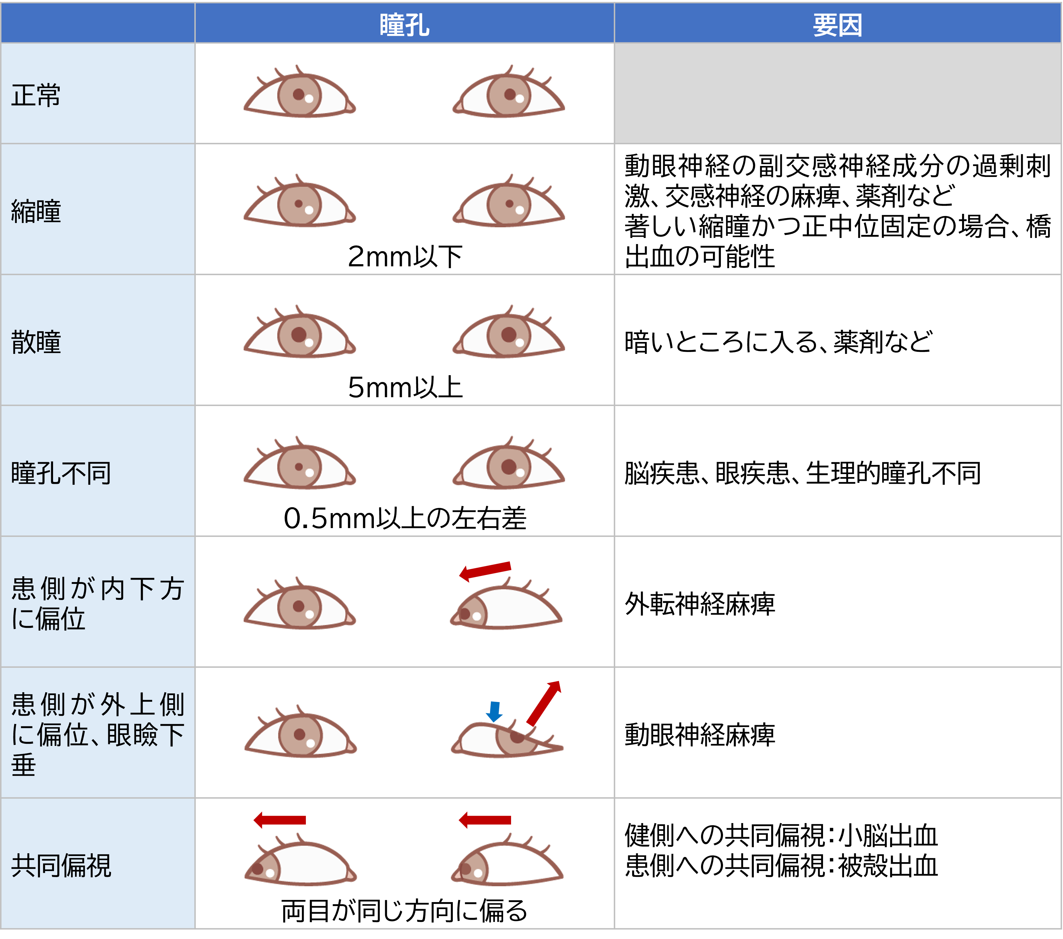 瞳孔所見
