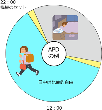 図2 APDの治療パターン例