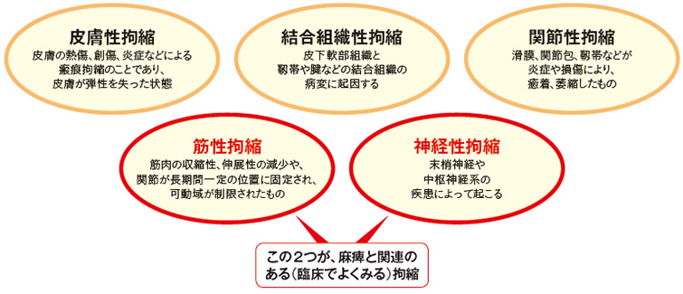 図1　Hoffaの分類