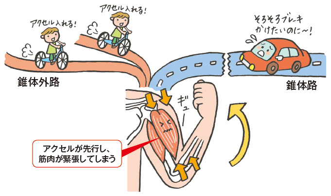 図3　麻痺が拘縮につながるしくみ