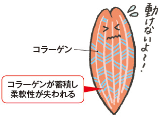 図4　筋肉へのコラーゲンの蓄積（イメージ）