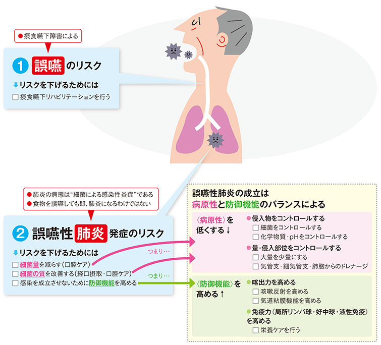 誤 嚥 性 肺炎 死亡 まで