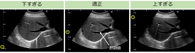 図12　フォーカス