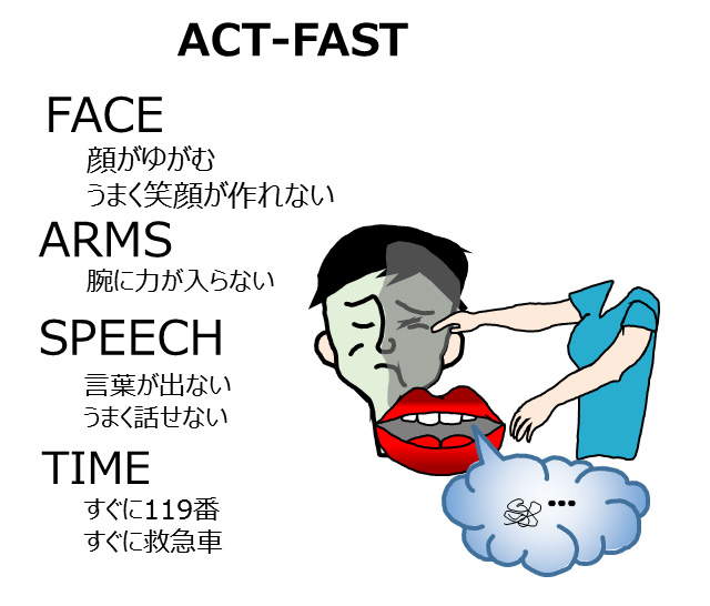 ACTｰFASTとは