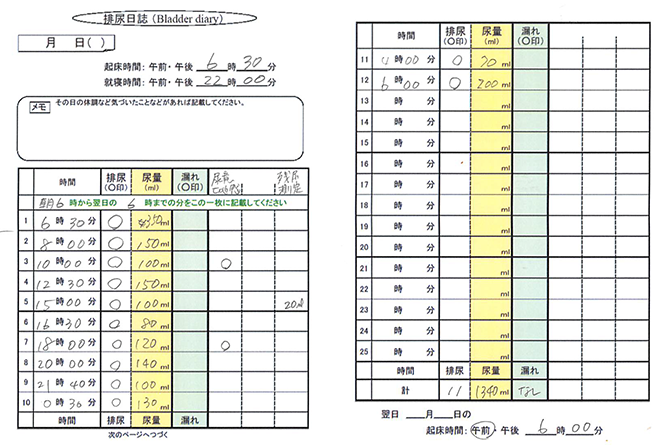 図１　排尿日誌の記載例