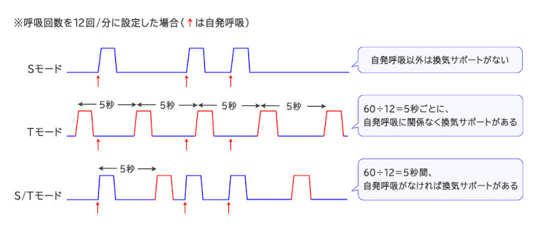 図2　NPPVの換気モードの比較イメージ