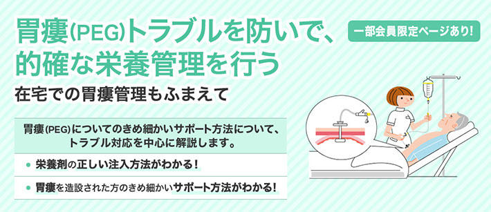 胃瘻(PEG)トラブルを防いで、的確な栄養管理を行う在宅での胃瘻管理もふまえて