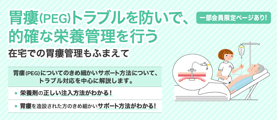 胃瘻(PEG)トラブルを防いで、的確な栄養管理を行う在宅での胃瘻管理もふまえて