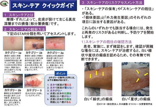 スキンテアハンドブックー成因 予防とケア もっとも安全 簡単 効果的なケア方法 医学と看護社