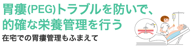 胃瘻（PEG）トラブルを防いで、的確な栄養管理を行う 在宅での胃瘻管理もふまえて