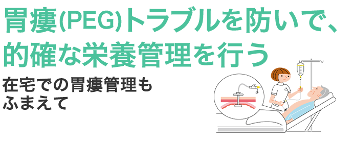 胃瘻（PEG）トラブルを防いで、的確な栄養管理を行う 在宅での胃瘻管理もふまえて