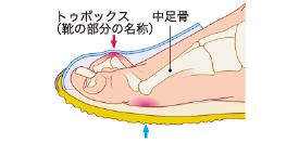 足 壊死 症状 👆糖尿病 初期 糖尿病性足病変の発生機序・原因・病態