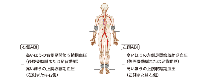 図4 ABIの測定