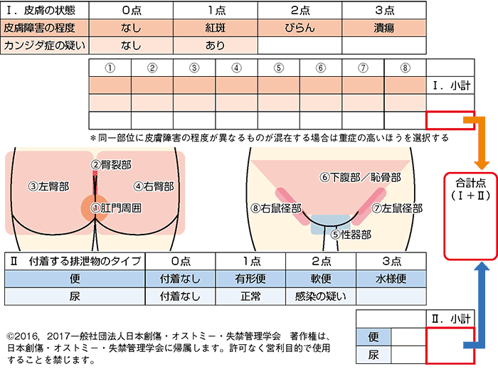 図１ IAD-set