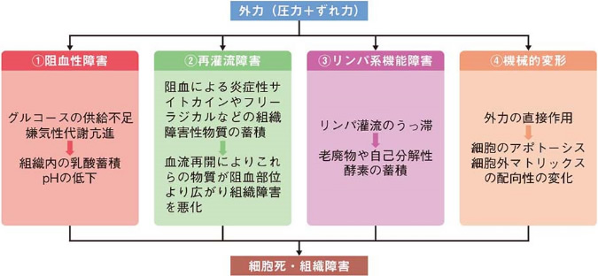 図４ 褥瘡発生のメカニズム