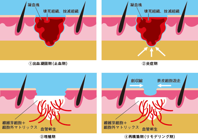 切り傷 ふさがる 時間