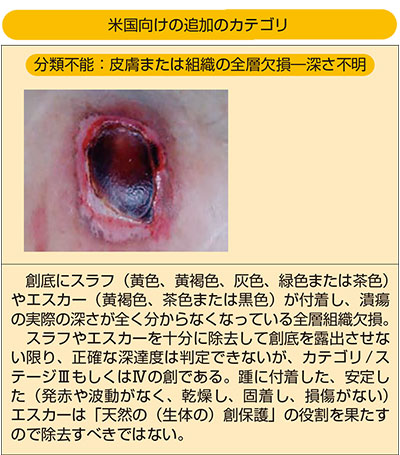 図１　NPUAP/EPUAP 分類