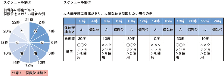 体位変換を2時間ごとにするって本当 Part4 褥瘡 じょくそう を防ぐために一番大事な体圧管理 アルメディアweb 体位変換を2時間ごとにするって本当 Part4 褥瘡 じょくそう を防ぐために一番大事な体圧管理 アルメディアweb
