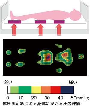 図１ 身体の構造と体圧と褥瘡の関係