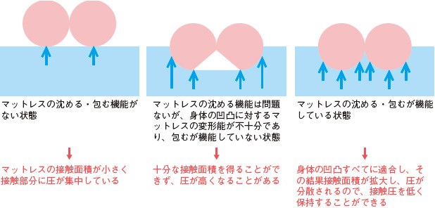 図１ 圧再分配のイメージ図