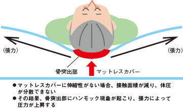 図１ ハンモック現象とは