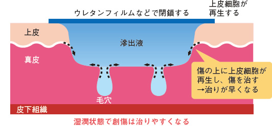 図１ 湿潤環境下で創がよくなる状態