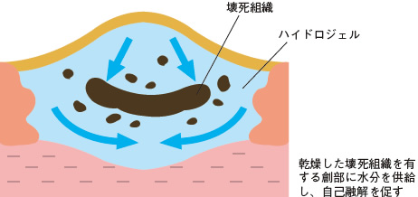 図２ ハイドロジェルの構造