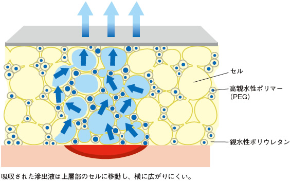 これだけは知っておきたいドレッシング材の使い方 Part6 褥瘡 じょくそう 治療 ケアのカギを握るドレッシング材 外用薬の使い方 アルメディアweb