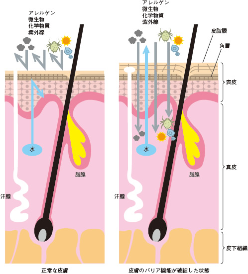 図１ 皮膚の構造とバリア機能の破綻