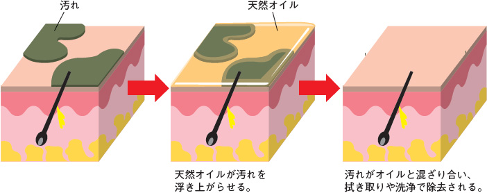 図２ 褥瘡周囲皮膚の汚れを清浄クリームで取り除く場合