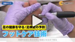 足の健康を守る「フットケア」技術