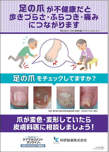 ケアマネジャーへ配付した爪白癬の啓発リーフレット