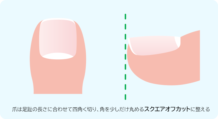 爪の切り方（スクエアオフカット）