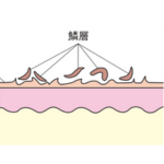 Q 鱗屑・落屑って何？ どうケアする？