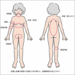 Q 一般的な皮膚のアセスメント法は？