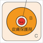 Q ストーマ周囲皮膚炎への対処法は？