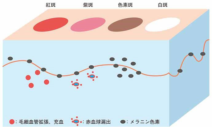 Q9 原発疹って何 Part1 健康な皮膚と異常な皮膚 アルメディアweb