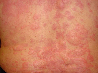 Q9 原発疹って何 Part1 健康な皮膚と異常な皮膚 アルメディアweb