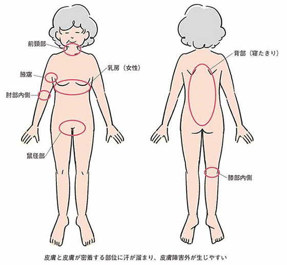 Q1 一般的な皮膚のアセスメント法は Part2 皮膚のアセスメントとスキンケアの基本テクニック アルメディアweb