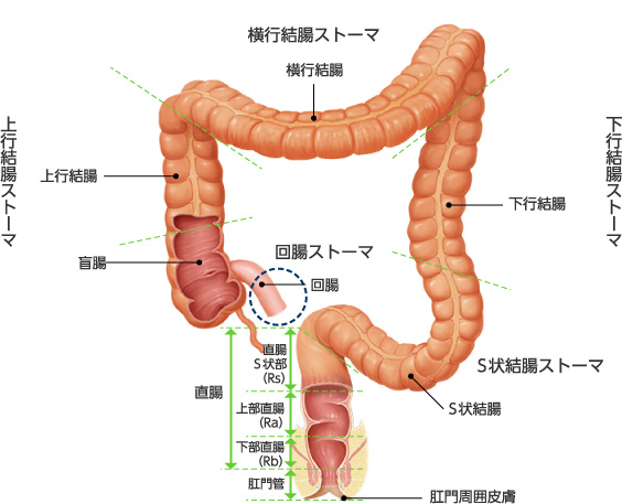 大腸の区分とストーマ