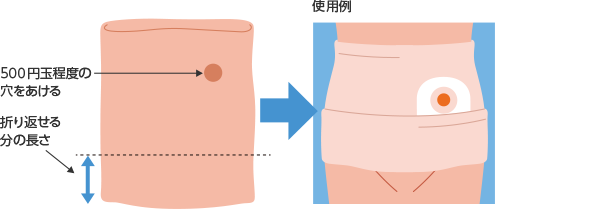 腹帯チューブの使用例