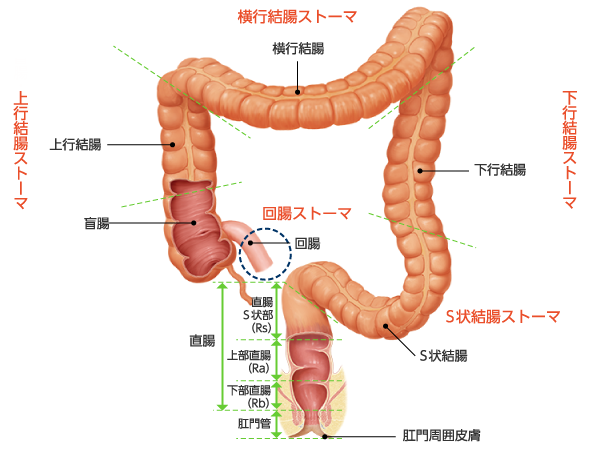 図2　大腸の区分とストーマ