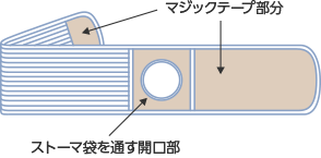 図３　ヘルニアベルト