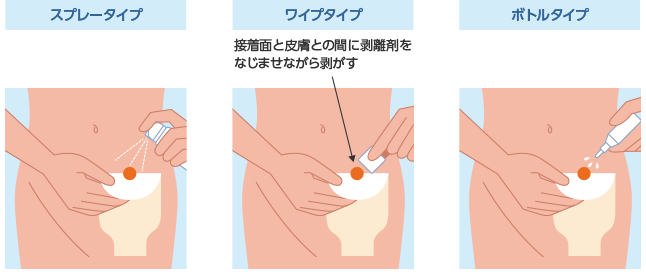 図４ 粘着剥離剤の形態