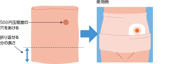図7　腹帯の使用例