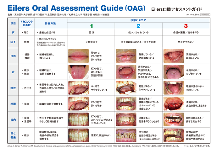 OAG（口腔アセスメントガイド）