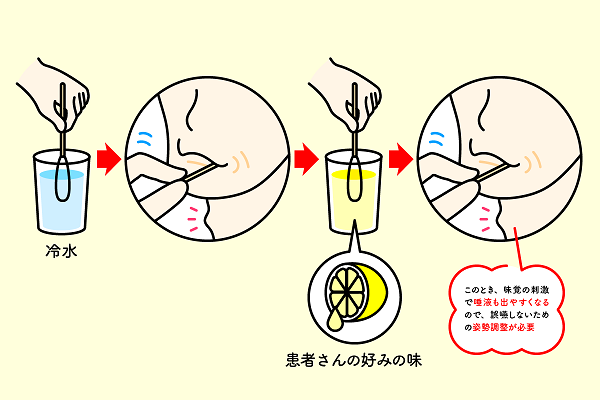 口腔内刺激訓練