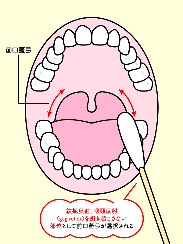 冷圧刺激法