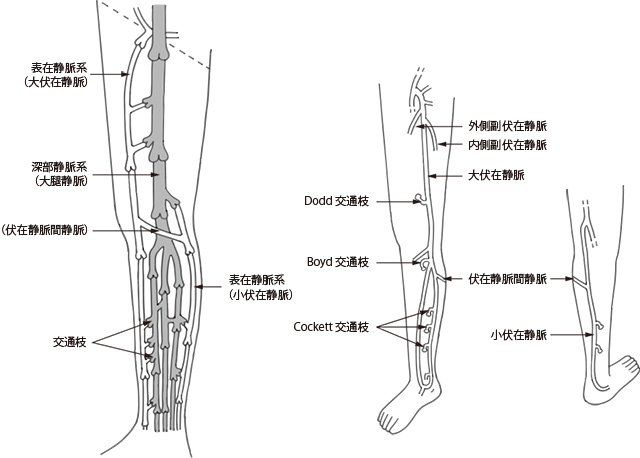 下肢静脈瘤とはどんな病気 下肢静脈瘤を正しく見極める アルメディアweb